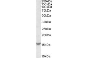 Western Blotting (WB) image for anti-DENN/MADD Domain Containing 5A (DENND5A) (N-Term) antibody (ABIN2786091) (DENND5A 抗体  (N-Term))