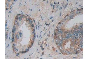 Immunohistochemistry (IHC) image for anti-Pyruvate Kinase M2 (PKM2) (AA 141-248) antibody (ABIN7432133)