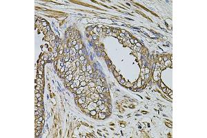 Immunohistochemistry of paraffin-embedded human prostate using CPOX antibody (ABIN5971997) at dilution of 1/100 (40x lens). (CPOX 抗体)