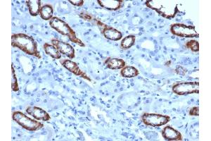 IHC analysis of formalin-fixed, paraffin-embedded human kidney.