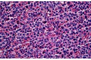Human Tonsil: Formalin-Fixed, Paraffin-Embedded (FFPE) (MKNK1 抗体  (AA 1-466))