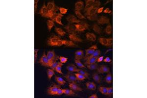 Immunofluorescence analysis of C6 cells using RPS8 antibody (ABIN7270041) at dilution of 1:100. (RPS8 抗体)