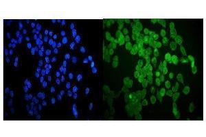 anti-Heat Shock Protein, alpha-Crystallin-Related, B6 (HSPB6) (AA 73-123) antibody