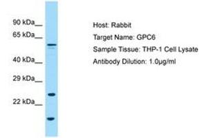 Image no. 1 for anti-Glypican 6 (GPC6) (AA 36-85) antibody (ABIN6749994) (Glypican 6 抗体  (AA 36-85))