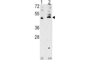 Western Blotting (WB) image for anti-Vascular Endothelial Growth Factor C (VEGFC) antibody (ABIN3001426)