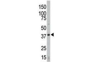 Western blot analysis of CDK4 antibody and HL-60 cell lysate (CDK4 抗体  (AA 273-305))