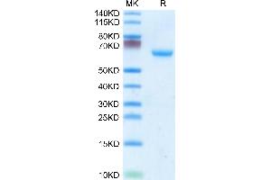 Mouse CHODL on Tris-Bis PAGE under reduced condition. (CHODL Protein (AA 22-216) (Fc Tag))