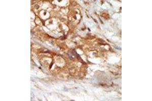 Image no. 2 for anti-Mitogen-Activated Protein Kinase Kinase Kinase 14 (MAP3K14) (Middle Region) antibody (ABIN360384) (MAP3K14 抗体  (Middle Region))