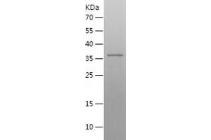 Western Blotting (WB) image for Necdin-Like 2 (NDNL2) (AA 1-304) protein (His tag) (ABIN7124123) (Necdin-Like 2 Protein (NDNL2) (AA 1-304) (His tag))