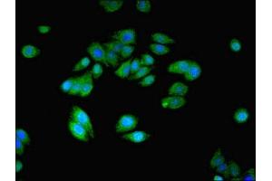 Immunofluorescent analysis of HepG2 cells using ABIN7161035 at dilution of 1:100 and Alexa Fluor 488-congugated AffiniPure Goat Anti-Rabbit IgG(H+L) (NANOS2 抗体  (AA 1-138))