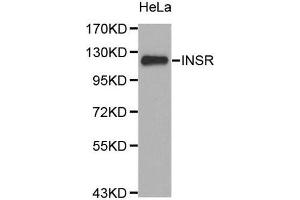 Western Blotting (WB) image for anti-Insulin Receptor (INSR) (N-Term) antibody (ABIN1513096) (Insulin Receptor 抗体  (N-Term))