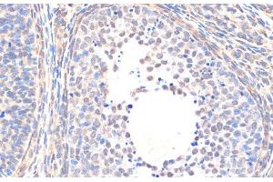 Immunohistochemistry of paraffin-embedded Rat ovary using Smad5 Polyclonal Antibody at dilution of 1:200 (40x lens).