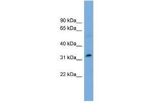 WB Suggested Anti-PHF13 Antibody Titration:  0. (PHF13 抗体  (Middle Region))