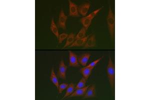 Immunofluorescence analysis of NIH/3T3 cells using Lumican (LUM) Rabbit pAb (ABIN6128190, ABIN6143388, ABIN6143389 and ABIN6220988) at dilution of 1:100 (40x lens). (LUM 抗体  (AA 19-338))