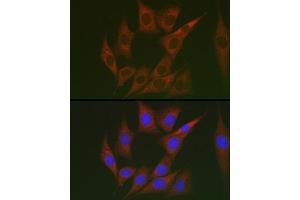 Immunofluorescence analysis of NIH/3T3 cells using Lumican (LUM) Rabbit pAb (ABIN6128190, ABIN6143388, ABIN6143389 and ABIN6220988) at dilution of 1:100 (40x lens). (LUM 抗体  (AA 19-338))
