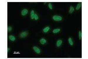 Immunostaining analysis in HeLa cells. (NAA38 抗体)