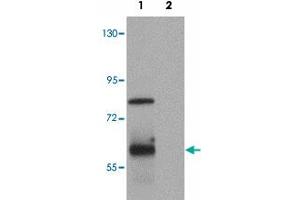 Western blot analysis of TSN in rat lung tissue lysate with TSN polyclonal antibody  at (1) 0. (Translin 抗体  (C-Term))