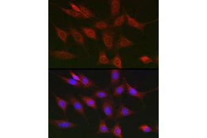 Immunofluorescence analysis of NIH/3T3 cells using RIPK1/RIP Rabbit pAb (ABIN6132596, ABIN6146959, ABIN6146960 and ABIN6223282) at dilution of 1:150 (40x lens). (RIPK1 抗体  (AA 170-440))