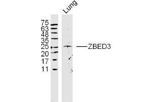 Rat lung lysates probed with ZBED3 Polyclonal Antibody, Unconjugated  at 1:300 dilution and 4˚C overnight incubation. (ZBED3 抗体  (AA 51-150))
