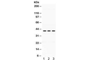 Western blot testing of 1) rat lung, 2) mouse liver and 3) human HepG2 lysate with Alcohol dehydrogenase antibody at 0. (ADH1A 抗体)