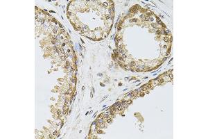 Immunohistochemistry of paraffin-embedded human prostate using POP4 antibody (ABIN5972510) at dilution of 1/100 (40x lens). (RPP29 抗体)