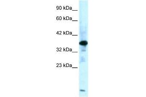 Human Muscle; WB Suggested Anti-ZFPL1 Antibody Titration: 0. (ZFPL1 抗体  (Middle Region))