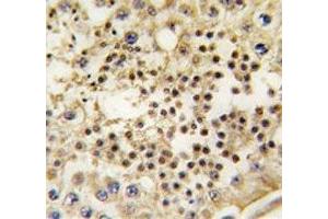 IHC analysis of FFPE human testis tissue stained with LIN28A antibody (LIN28A 抗体)