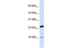 TAF13 antibody used at 0. (TAF13 抗体  (N-Term))