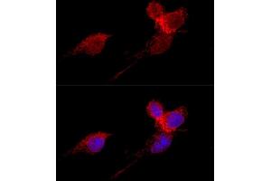 Immunofluorescence (IF) image for anti-Ribosomal Protein L36 (RPL36) (AA 1-105) antibody (ABIN6147141)