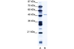 WB Suggested Anti-ZNF627 Antibody   Titration: 1. (ZNF627 抗体  (N-Term))