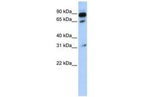 Image no. 1 for anti-ATP-Binding Cassette, Sub-Family D (Ald), Member 4 (ABCD4) (AA 108-157) antibody (ABIN6740835) (ABCD4 抗体  (AA 108-157))