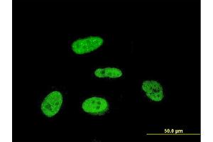 Immunofluorescence of monoclonal antibody to PRKRIP1 on HeLa cell.