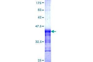 Image no. 1 for K-Cadherin (CDH6) (AA 513-612) protein (GST tag) (ABIN1348922) (CDH6 Protein (AA 513-612) (GST tag))