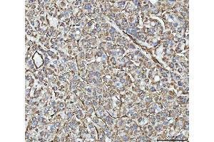 IHC analysis of PTRF/CAVIN1 using anti-PTRF/CAVIN1 antibody (ABIN7601817). (PTRF 抗体  (AA 47-390))
