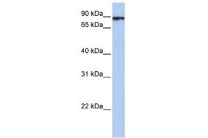 HSPA4L antibody used at 1 ug/ml to detect target protein. (HSPA4L 抗体  (C-Term))