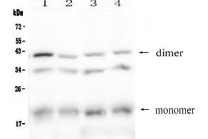 Western blot analysis of BAFF Receptor using anti-BAFF Receptor antibody . (TNFRSF13C 抗体  (AA 1-71))