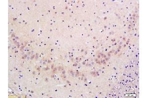 Formalin-fixed and paraffin embedded: rat brain tissue labeled with Anti-FLIP/c FLIP Polyclonal Antibody , Unconjugated at 1:300 followed by conjugation to the secondary antibody and DAB staining (FLIP 抗体  (AA 7-100))