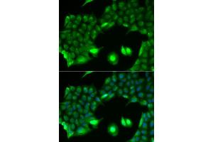 Immunofluorescence analysis of HeLa cells using SSX2 antibody. (SSX2 抗体)