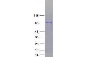 Western Blotting (WB) image for Zinc Finger Protein 205 (ZNF205) (Transcript Variant 2) protein (Myc-DYKDDDDK Tag) (ABIN2735955)