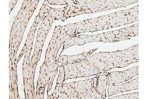 IHC analysis of PPCS using anti-PPCS antibody (ABIN7602752).