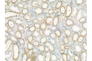 ABIN6264177 and ABIN6273064 at 1/100 staining human normal kidney tissue by IHC-P. (PHGDH 抗体  (N-Term))
