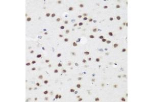 Immunohistochemistry of paraffin-embedded mouse brain using  antibody (ABIN6131366, ABIN6136608, ABIN6136609 and ABIN6223268) at dilution of 1:200 (40x lens). (AEBP2 抗体  (AA 234-503))