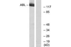 Western blot analysis of extracts from RAW264. (ABL1 抗体  (AA 406-455))