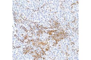 Immunohistochemistry (IHC) image for anti-Signal Transducer and Activator of Transcription 5A (STAT5A) (AA 744-794) antibody (ABIN7454017)