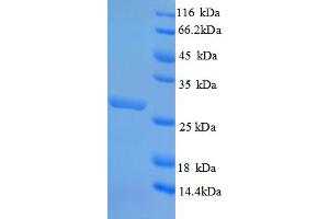 SDS-PAGE (SDS) image for Oxidized Low Density Lipoprotein (Lectin-Like) Receptor 1 (OLR1) (AA 58-273), (Extracellular) protein (His tag) (ABIN5710047)