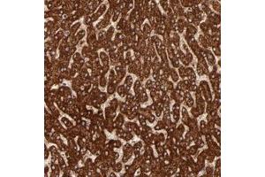 Immunohistochemical staining of human liver with DLST polyclonal antibody  shows strong cytoplasmic positivity in hepatocytes.