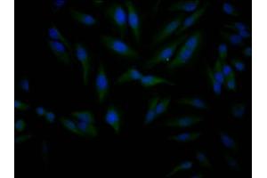 Immunofluorescence staining of Hela Cells with ABIN7127809 at 1:50, counter-stained with DAPI. (Recombinant SIRT1 抗体)