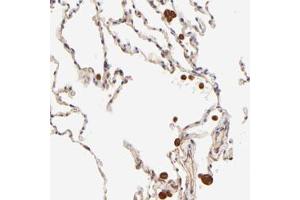 Immunohistochemical staining of human lung with TNFAIP3 polyclonal antibody  shows strong cytoplasmic positivity in macrophages. (TNFAIP3 抗体)