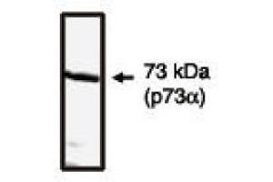 Image no. 1 for anti-Tumor Protein P73 (TP73) (C-Term) antibody (ABIN265052) (Tumor Protein p73 抗体  (C-Term))