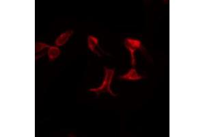 ABIN6274712 staining LOVO by IF/ICC. (AGPAT5 抗体  (Internal Region))
